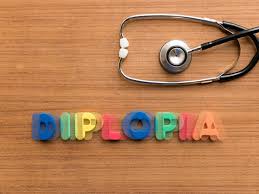 La visione doppia. Cos'è la diplopia?